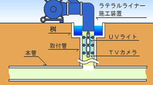 5. ラテラルライナー形成工
